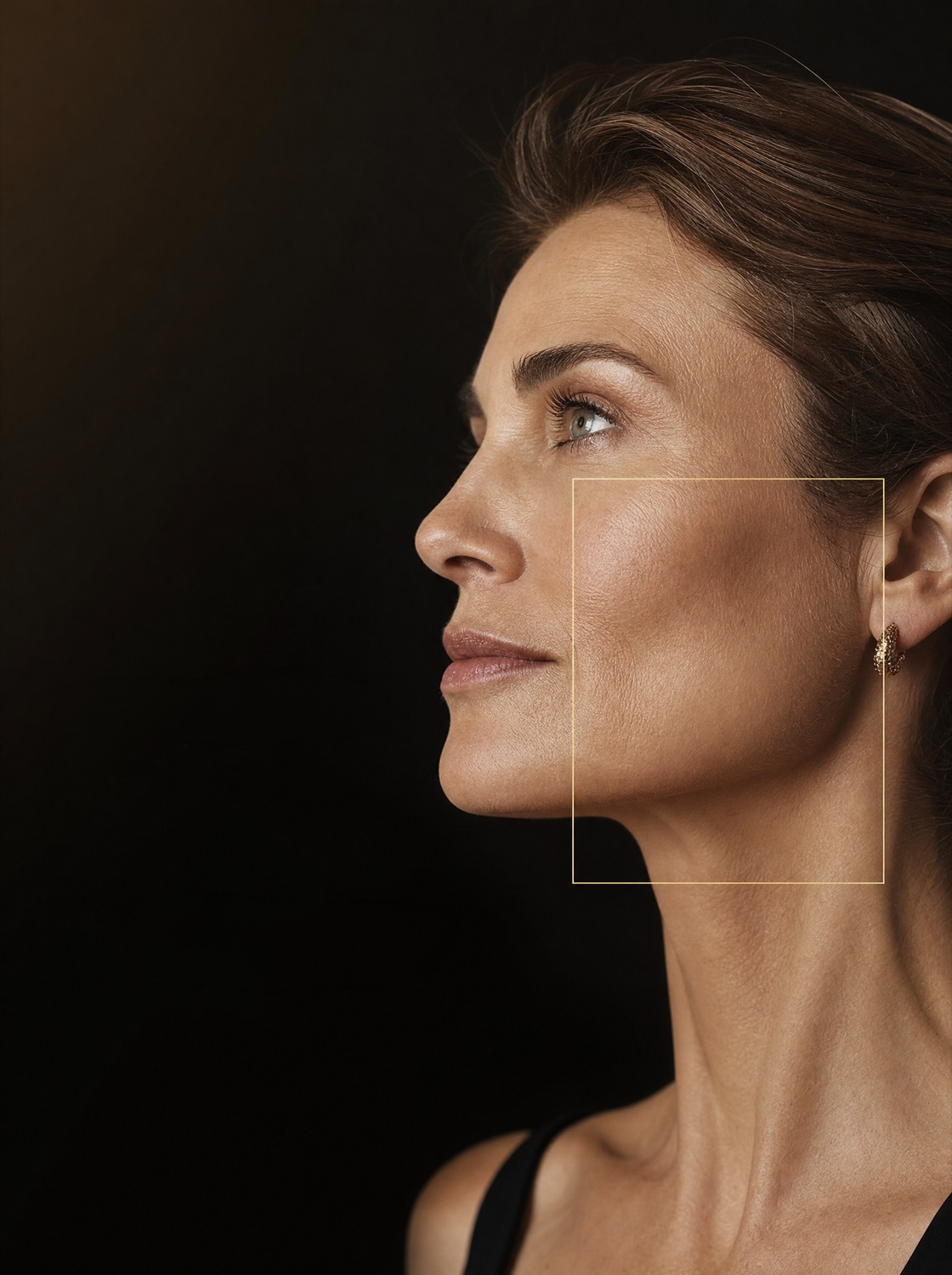 Aptos thread lift result by Samira