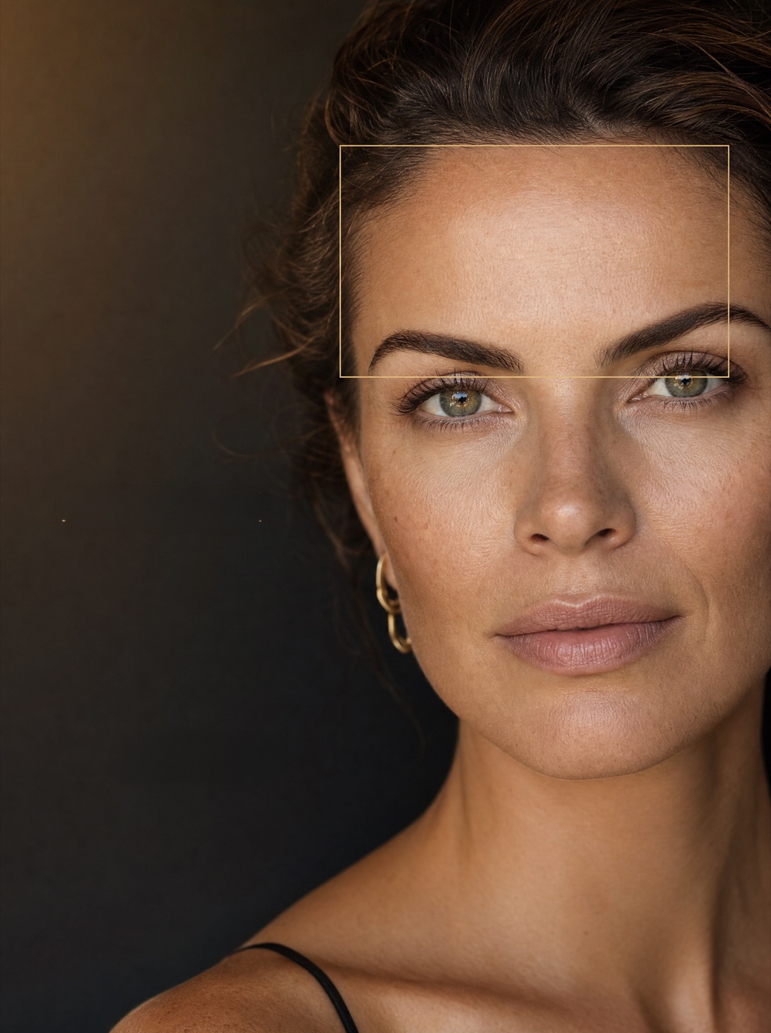 Botox result by Samira