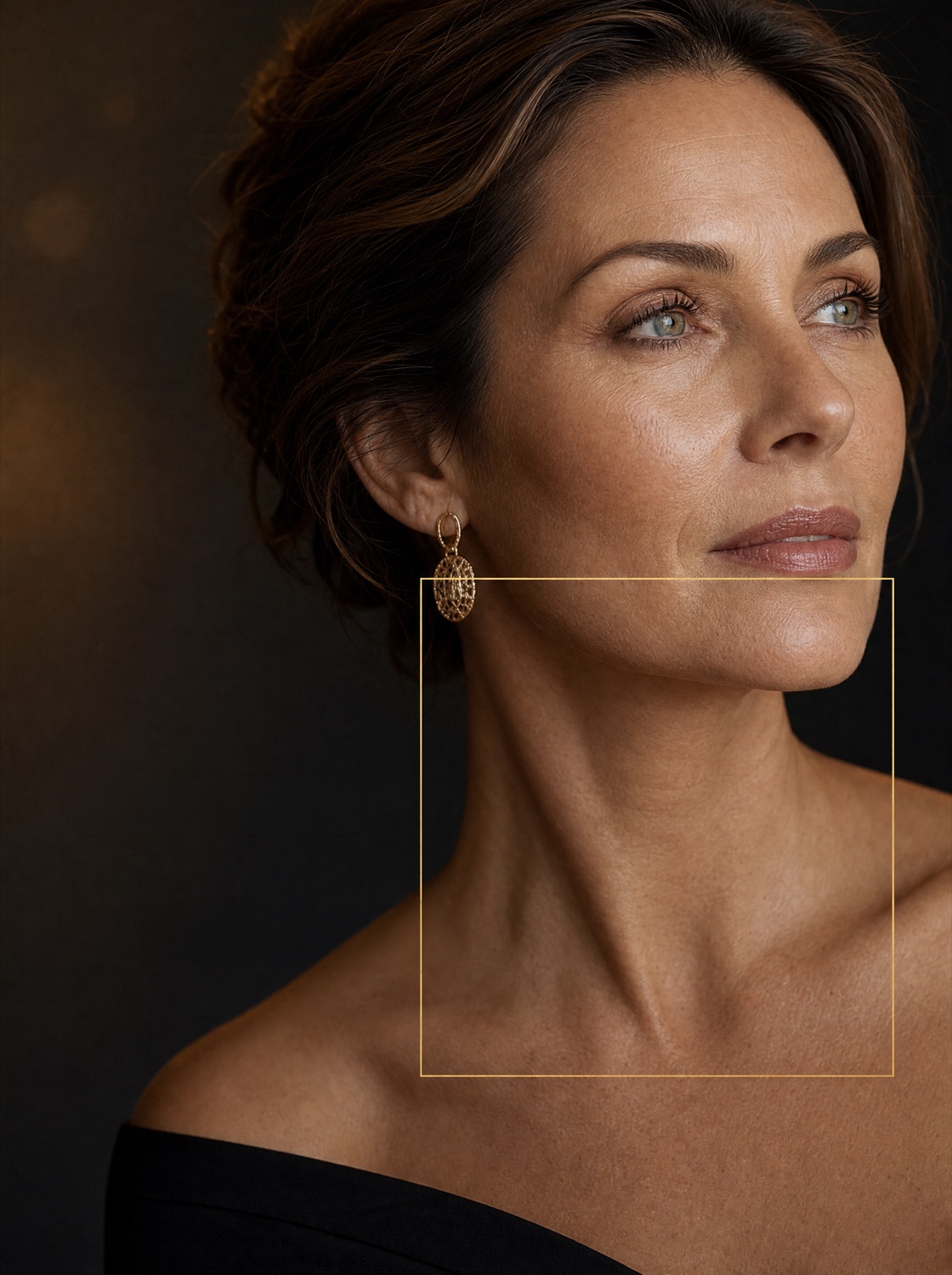 Ultherapy result by Samira