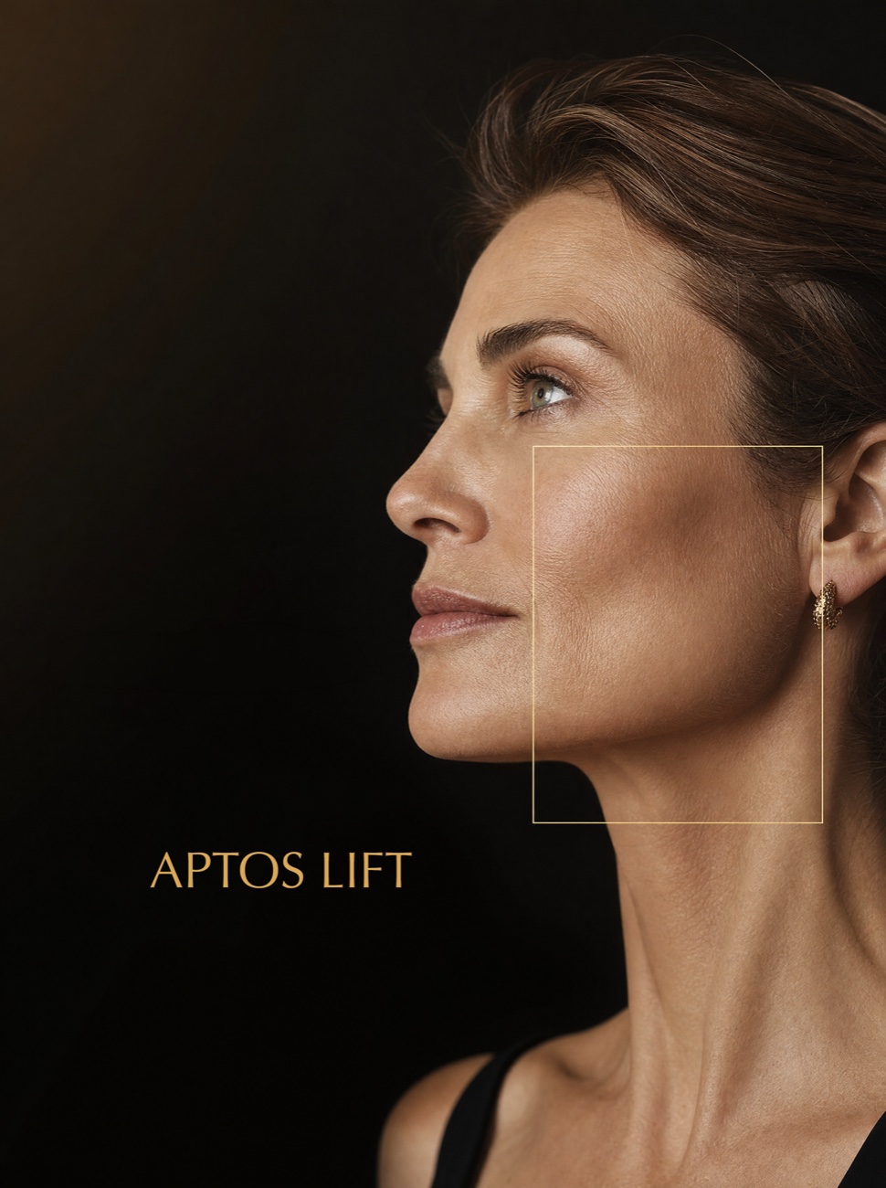 Aptos thread lift